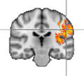 Cortex
